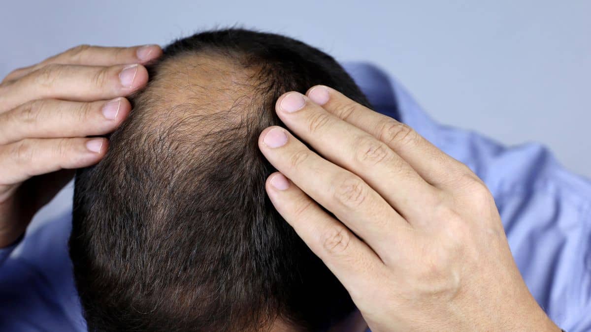 Cette épice de cuisine favoriserait la pousse des cheveux et lutterait contre la calvitie